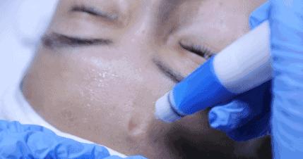 苏州皮肤管理推荐,苏州皮肤管理哪里做得好