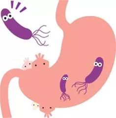 幽门螺旋杆菌不治疗会有什么后果,幽门螺旋杆菌可以彻底消灭吗