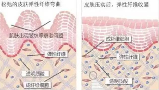 温碧霞同学照片,温碧霞和同学的差距