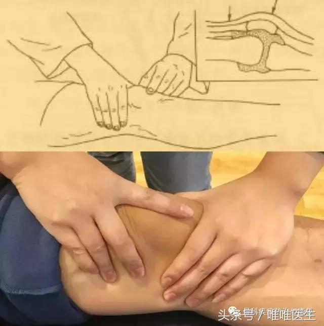 滑膜炎深度讲解（一）——华中科技大学附属协和骨科医院专家