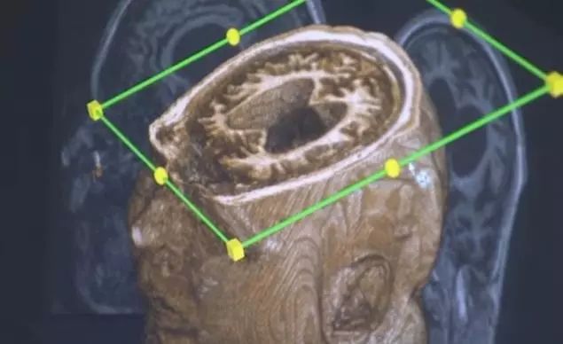 死亡意思解释,死亡说明了什么道理