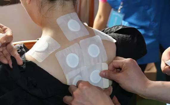 「三九贴来袭」这个冬天不太冷！二院康复科三九贴明天开始，您约了么~