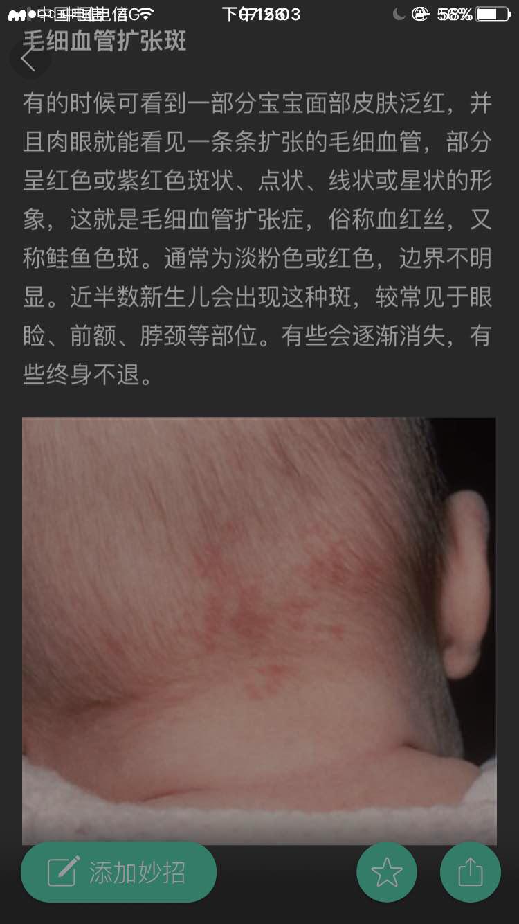宝宝出生就有胎记是宝妈的原因吗,宝宝有胎记的宝妈们都去了吗