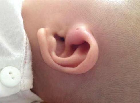 仓眼为什么是黑色,为什么会有仓眼