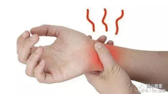 大盘点！支架术后最常见的9大症状，你中招了几条？