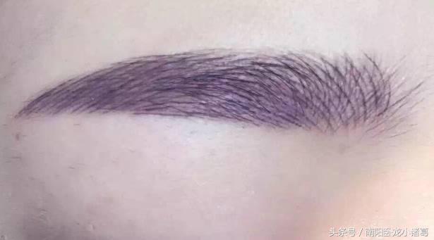 南阳时光整形美容,南阳提眉整形