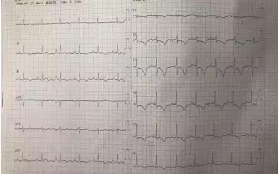 一天抢救两次,一天抢救两次还有救吗