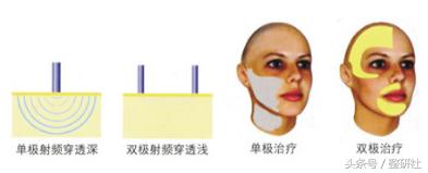 灿烂轻*女熟**养成计——修复细纹