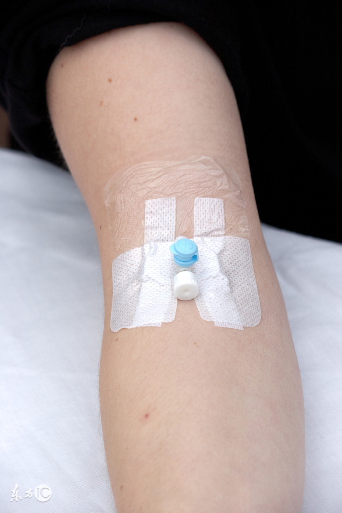 怎么减轻补钾药对胃的刺激,静脉补钾的方法及原则