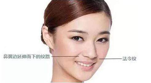 纹法令纹最有效办法,有法令纹怎么去消法令纹