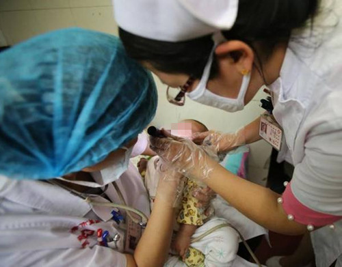 新生儿宝宝嘴巴长脓泡,宝宝嘴里上颚有脓包