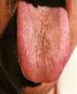 蒲辅周讲舌诊,蒲辅周怎么看舌诊