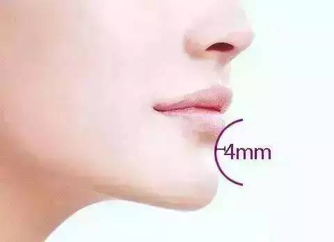 丰下巴用玻尿酸好还是自体脂肪好,玻尿酸丰下巴后要注意哪些问题