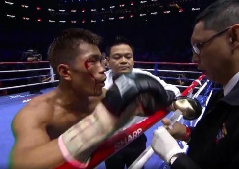 邹市明拳击比赛被打得最惨,邹市明拳击最惨败的一次