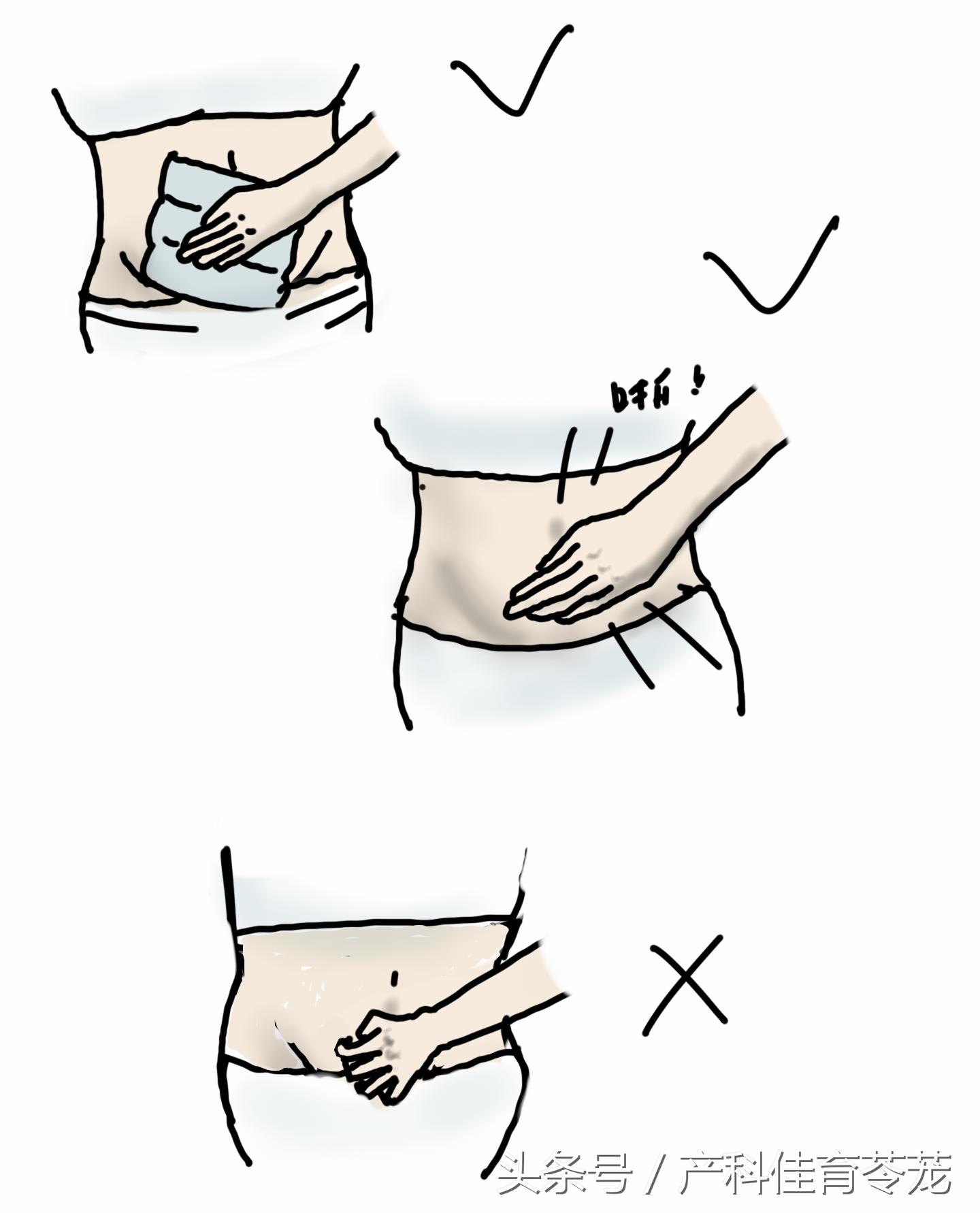 剖宫产疤痕开始痒怎么缓解,剖宫产后预防瘢痕的小技巧