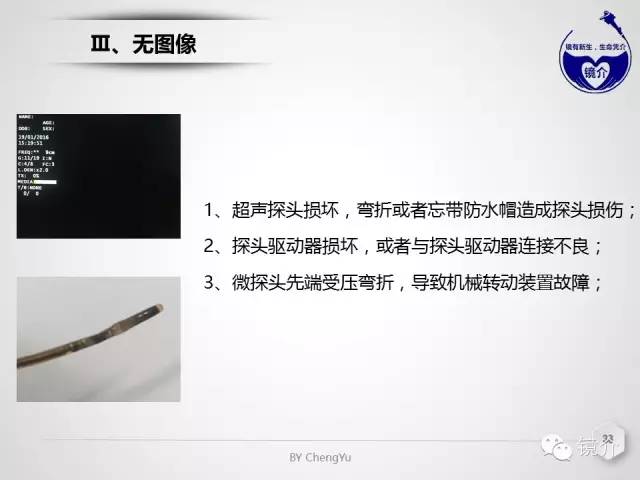 内镜超声小探头设定、使用、维护要点分析