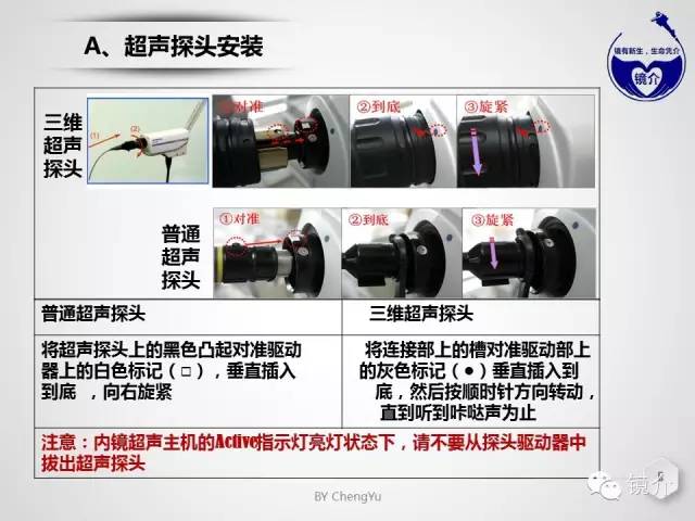 内镜超声小探头设定、使用、维护要点分析