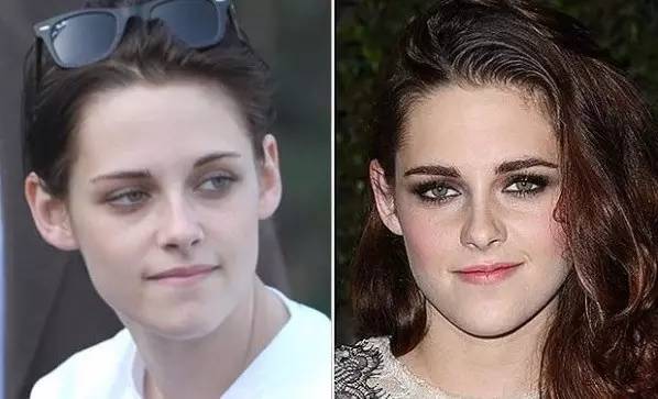 眼袋和卧蚕的区别看完你就知,卧蚕和眼袋的区别你知道吗