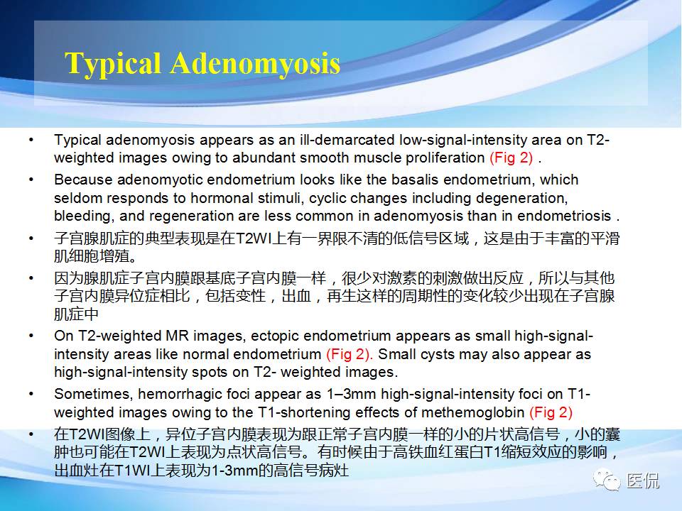 双语PPT：子宫腺肌症常见和不常见的MRI表现医学影像