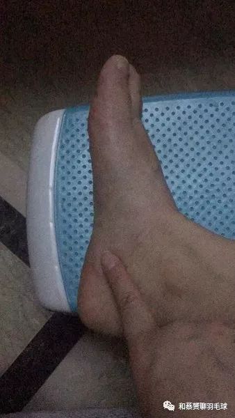 小腿前面的肌肉僵硬,小腿前方肌肉僵硬