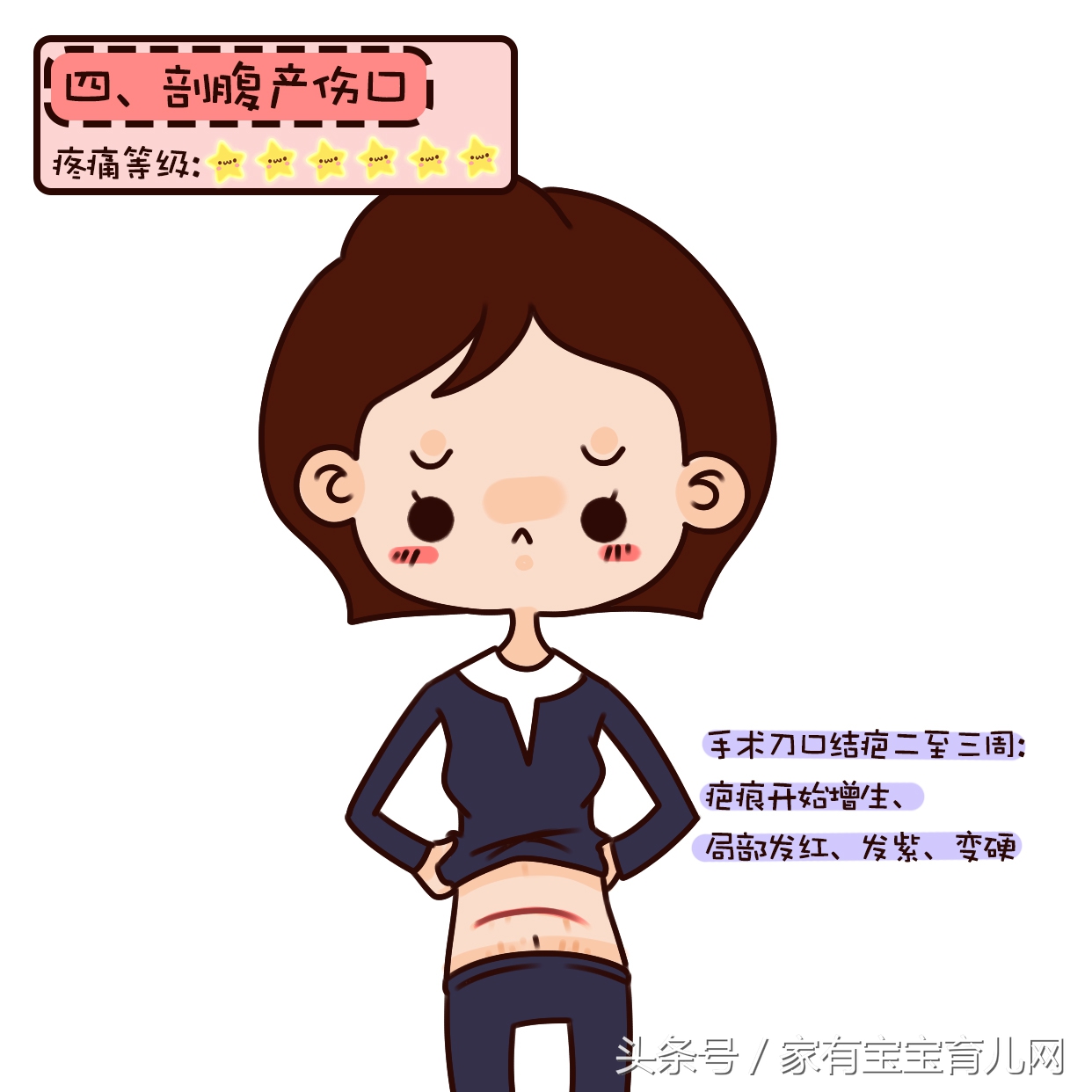 谁说剖腹产不痛了?剖腹产全过程疼痛等级大比拼,最后一步才最痛