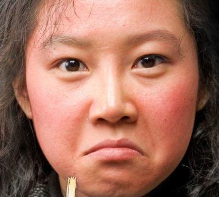 冬季脸蛋容易发红发烫，你可以这样护理皮肤