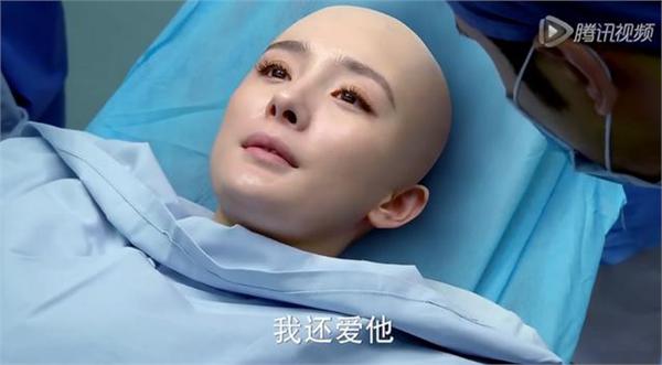 女明星没了刘海变好看了,女明星突然没头发了