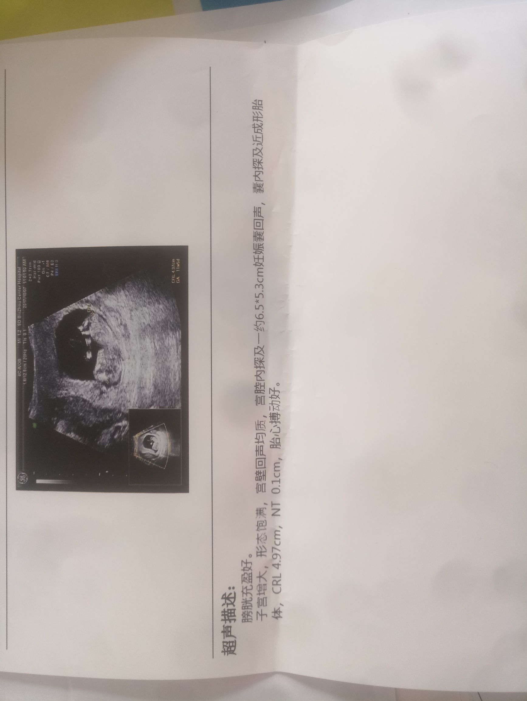 准妈妈去产检的路上,准妈妈产检