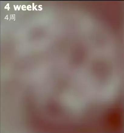 幼儿视力用视力表检查准确步骤,幼儿园孩子视力检测表准确吗