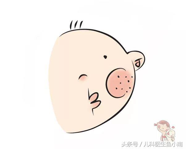 宝宝湿疹反反复复怎么根除,宝宝反复湿疹对付湿疹有妙招