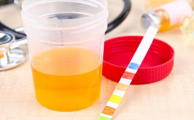 肾病尿蛋白经过药物治疗能消退吗,肾炎导致尿蛋白2+需要治疗吗