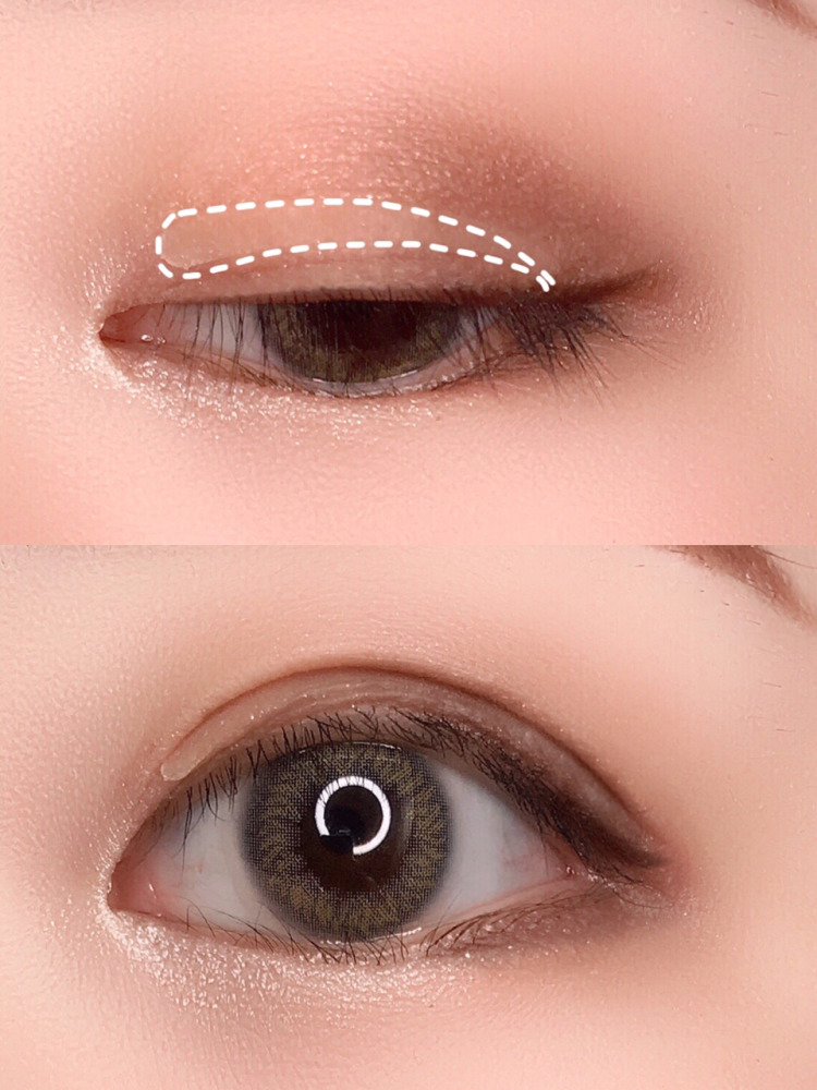 内双贴双眼皮贴可以变外双吗,内双肿眼泡怎么贴双眼皮新手教程