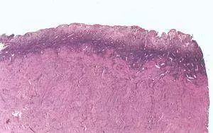 中国首例子宫移植成功案例,全球首例男性子宫移植成功