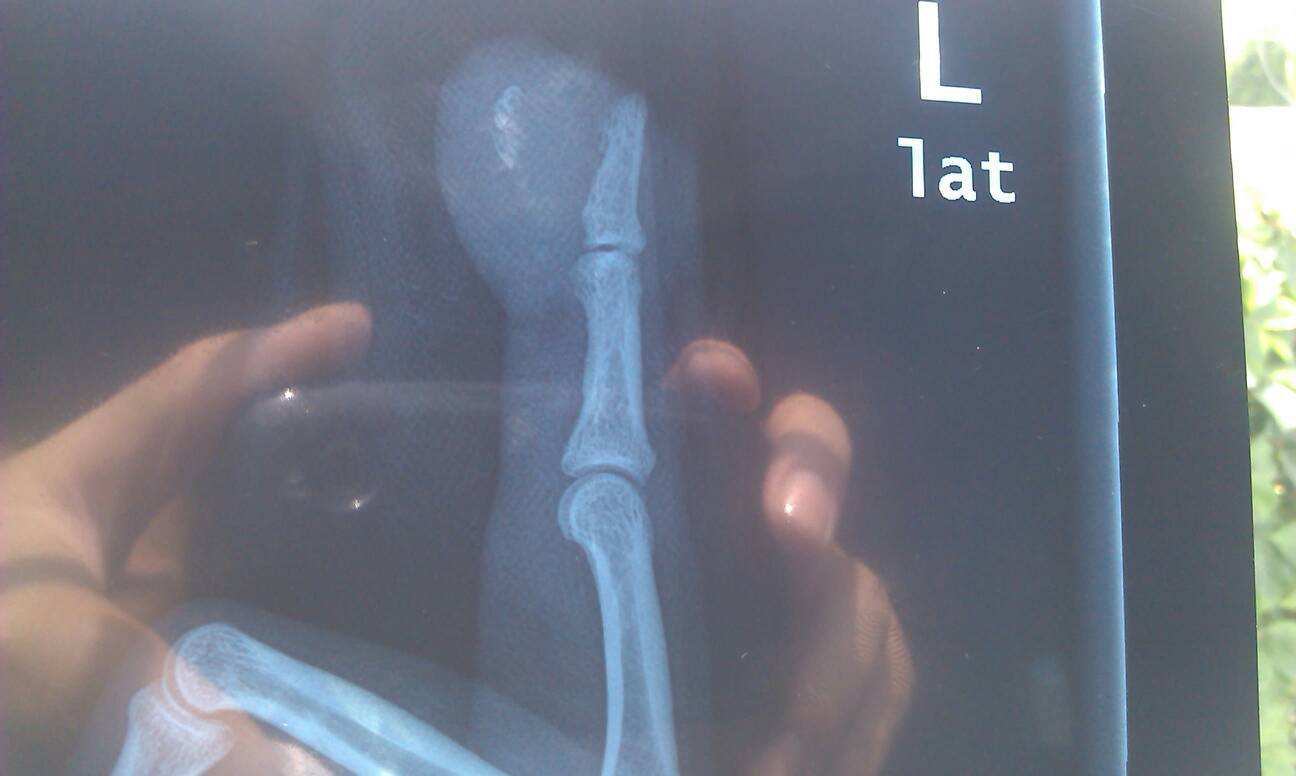 交通事故最新十级伤残鉴定标准,交通事故十级伤残鉴定标准2018