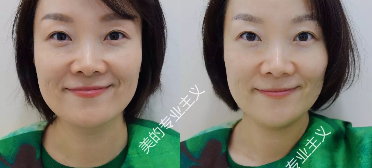 你皮肤怎么保养的,你皮肤怎么保养的视频