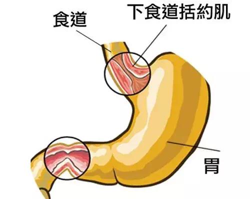 孕妈妈反酸,孕妈妈烧心是宝宝长头发了吗