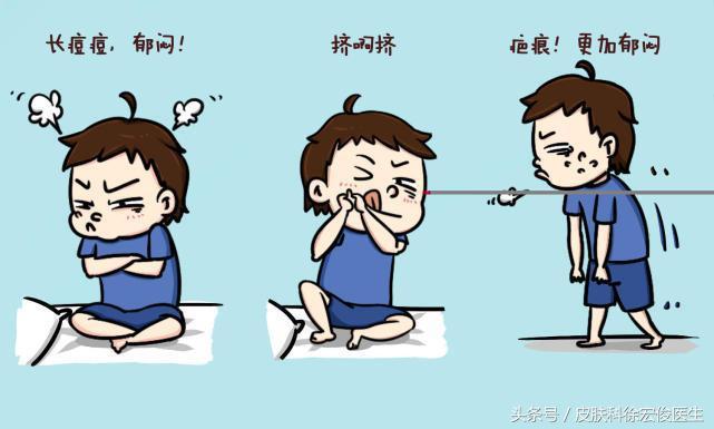 治疗痘痘的药剂,治疗痘痘的药能乱吃吗