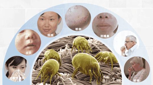 猫猫皮肤螨虫感染图片,螨虫感染皮肤瘙痒怎么办