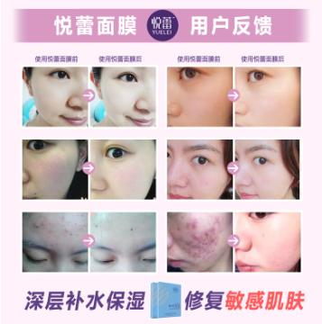 悦蕾焕颜蚕丝面膜,悦蕾面膜