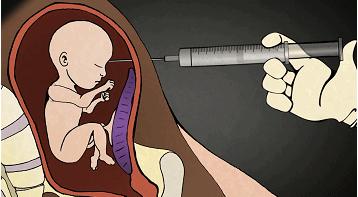 堕胎时人类是怎样一步步杀死自己孩子的?妈妈会看哭!