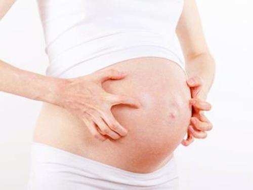 孕期皮肤痒怎么处理,孕妇怀孕期间皮肤痒怎么办小妙招