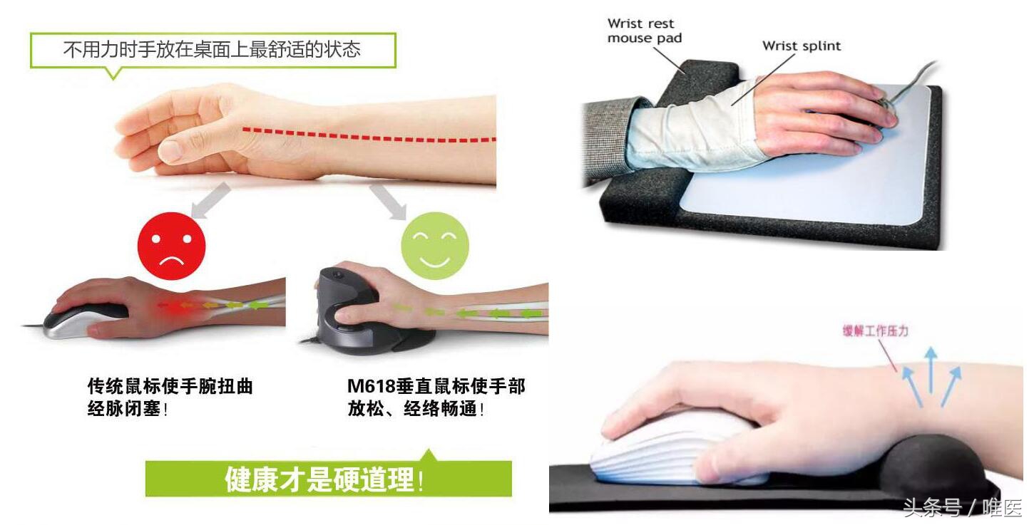 腱鞘炎治疗过程疼到尖叫视频,腱鞘炎跳一跳