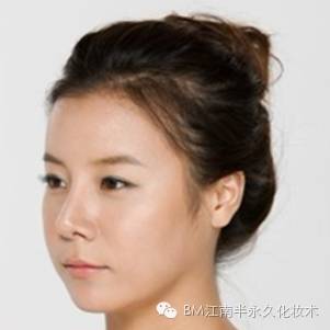 发际线很秃的女星,调整过发际线的明星