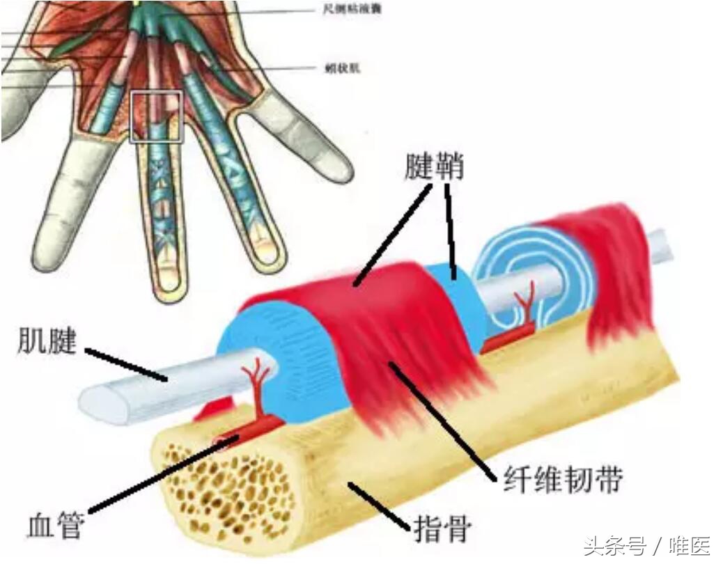 腱鞘炎治疗过程疼到尖叫视频,腱鞘炎跳一跳