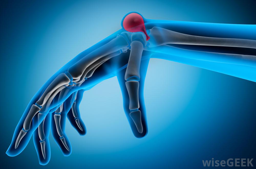 手腕上长了这种奇怪的鼓包，是肿瘤么？