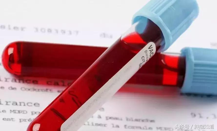 一滴血能查出十种癌吗,一滴血测癌明年启动试验