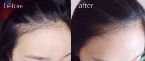 防脱育发洗发水哪个牌子最有效,国药集团天目湖防脱育发洗发水