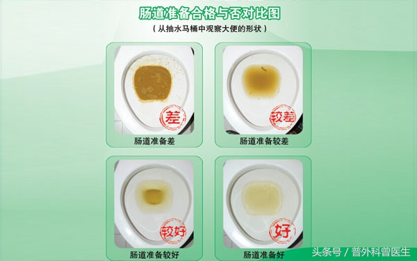 肠镜检查是怎么做的,胃镜肠镜检查前注意事项及禁忌症