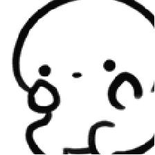 睫毛里竟住着虫子，吓死宝宝了！眼睛干痒的你一定要看看