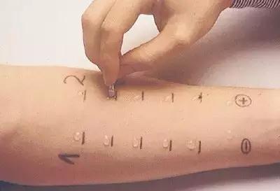 宝宝湿疹需要忌口鱼吗,过敏湿疹十大忌口水果